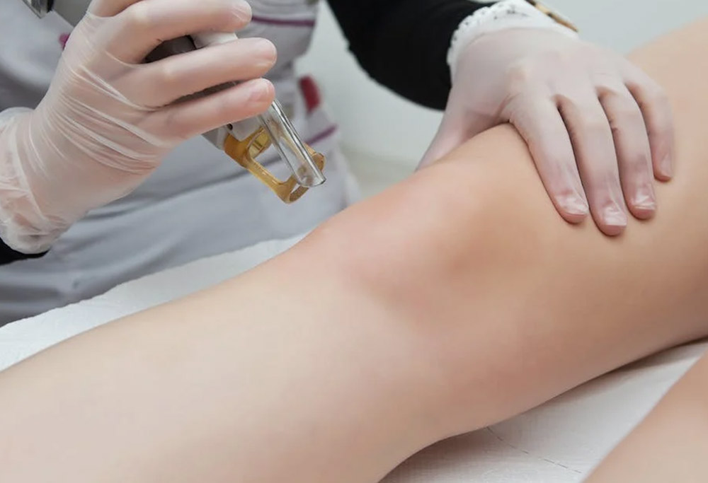 How to Become a Laser Technician in Canada | APT Injection Training How to Become a Laser Technician in Canada | APT Injection Training