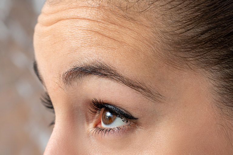 A woman with wrinkles on her forehead
