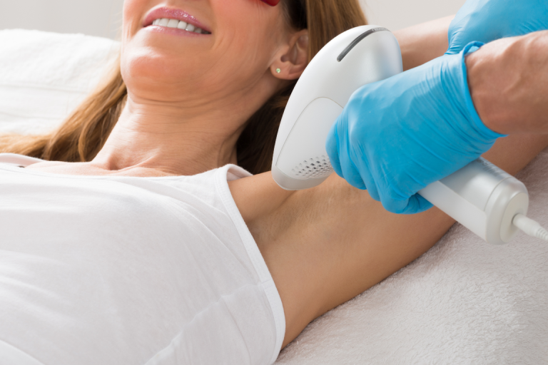a patient receives a laser hair removal treatment on her underarms