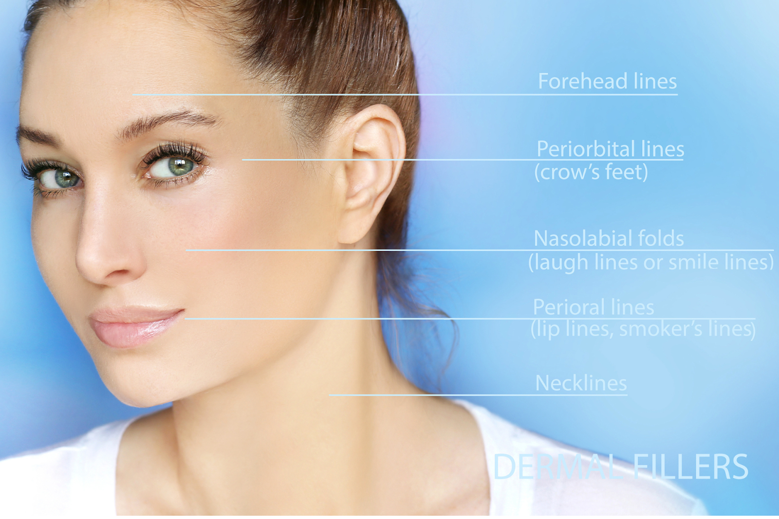 Dermal filler injection for specific areas of the face 