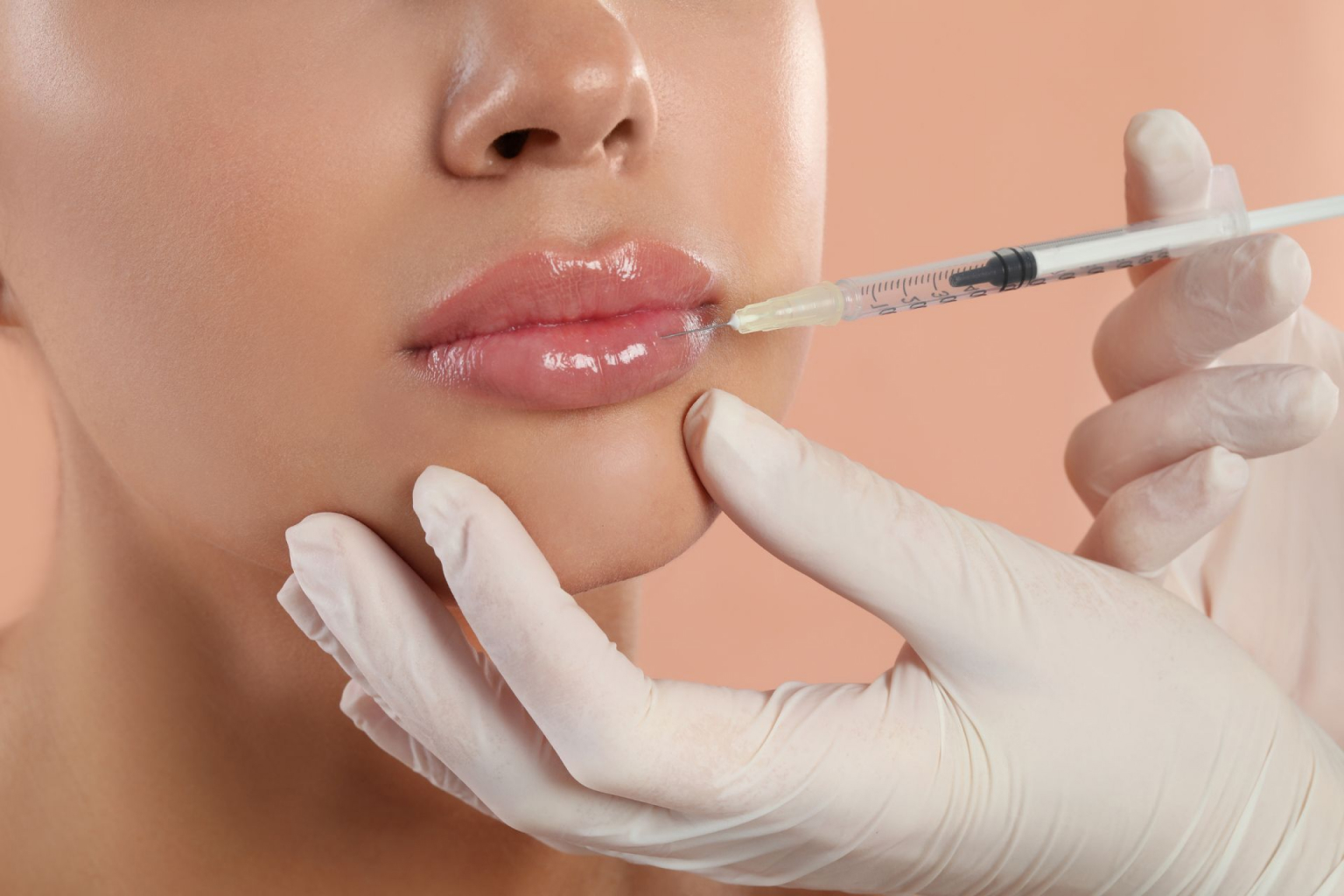 A woman receiving more lip filler