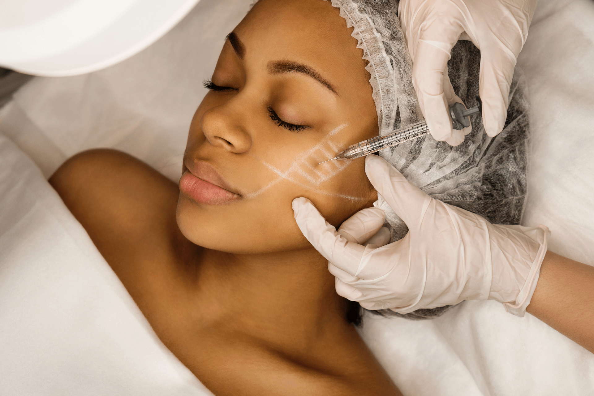 A woman getting a filler injection on her cheek