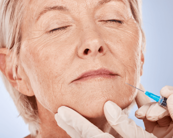 A middle-aged woman receives a hyperdiluted Radiesse injection around her mouth