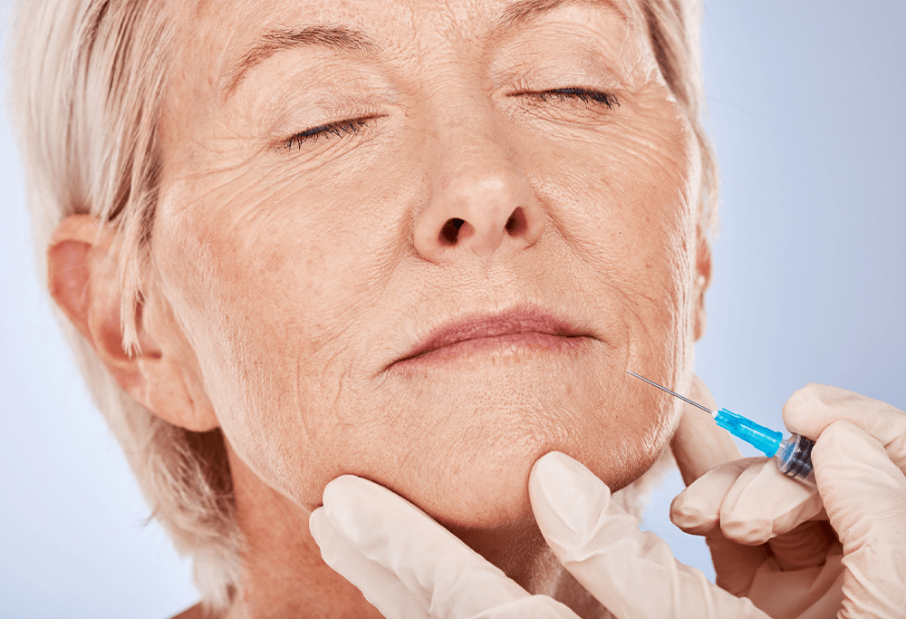 A middle-aged woman receives a hyperdiluted Radiesse injection around her mouth